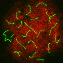 Image shows spermatocytes in mice deficient for a Fanconi anemia pathway protein, Fancd2.